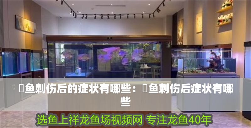 魟魚刺傷后的癥狀有哪些:魟魚刺傷后癥狀有哪些 魟魚百科 第2張 魟魚刺傷后的癥狀有哪些:魟魚刺傷后癥狀有哪些 魟魚刺傷后的癥狀有哪些:魟魚刺傷后癥狀有哪些 魟魚百科 第2張