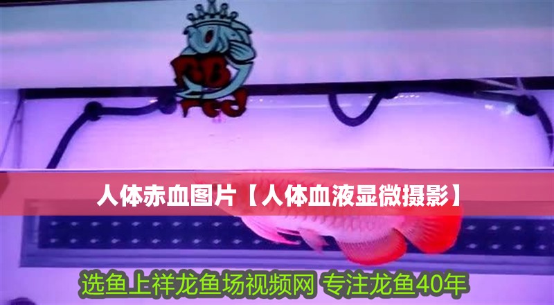 人體赤血圖片【人體血液顯微攝影】