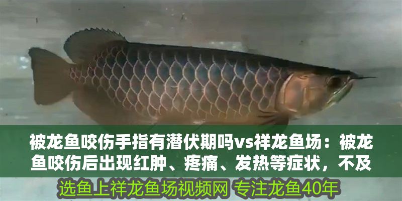 被龍魚咬傷手指有潛伏期嗎vs祥龍魚場：被龍魚咬傷后出現(xiàn)紅腫、疼痛、發(fā)熱等癥狀，不及時處理