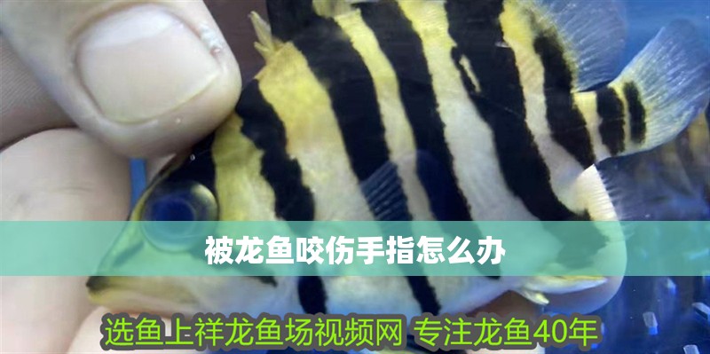 被龍魚咬傷手指怎么辦