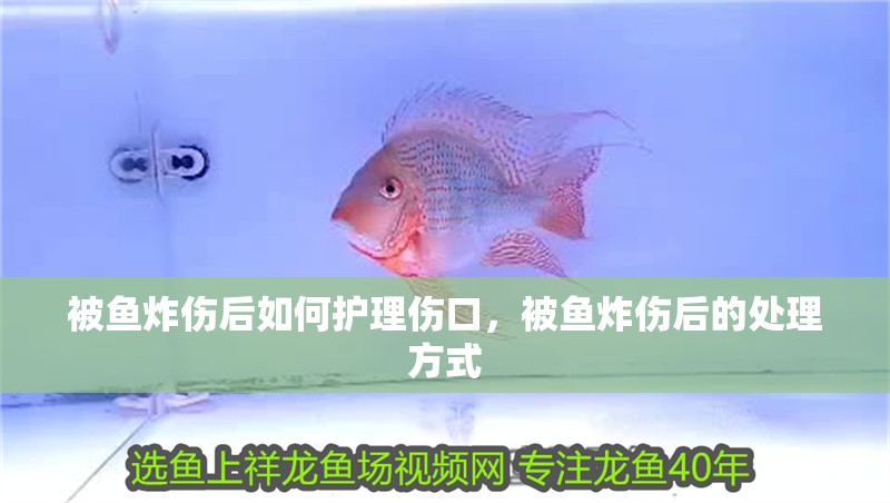 被魚炸傷后如何護理傷口，被魚炸傷后的處理方式