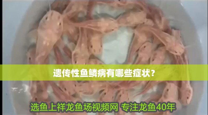 遺傳性魚鱗病有哪些癥狀？