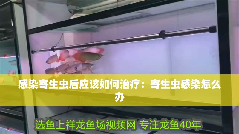 感染寄生蟲后應該如何治療：寄生蟲感染怎么辦