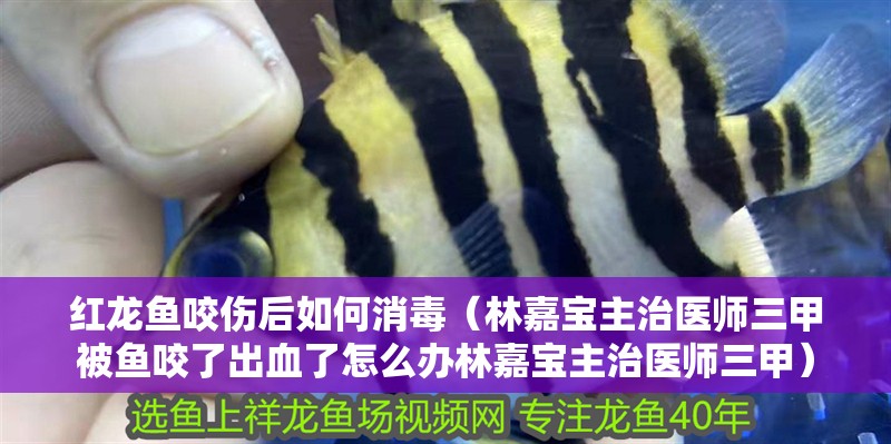 紅龍魚咬傷后如何消毒（林嘉寶主治醫師三甲被魚咬了出血了怎么辦林嘉寶主治醫師三甲）