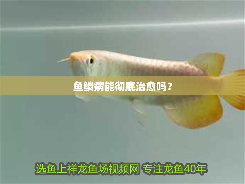 魚鱗病能徹底治愈嗎？