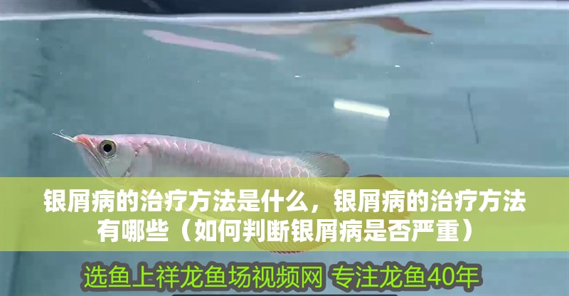 銀屑病的治療方法是什么，銀屑病的治療方法有哪些（如何判斷銀屑病是否嚴(yán)重）