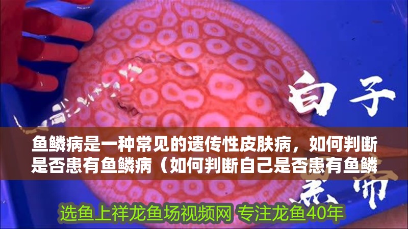 魚鱗病是一種常見的遺傳性皮膚病，如何判斷是否患有魚鱗病（如何判斷自己是否患有魚鱗病）