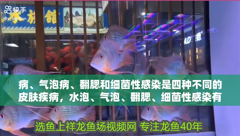 病、氣泡病、翻腮和細菌性感染是四種不同的皮膚疾病，水泡、氣泡、翻腮、細菌性感染有什么區別？