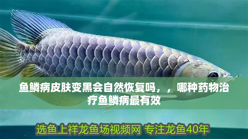 魚鱗病皮膚變黑會自然恢復嗎，，哪種藥物治療魚鱗病最有效