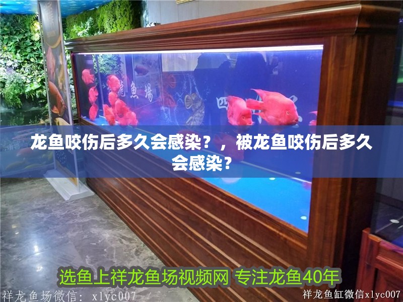 龍魚咬傷后多久會感染?,被龍魚咬傷后多久會感染? 龍魚百科 第2張 龍魚咬傷后多久會感染?,被龍魚咬傷后多久會感染? 龍魚咬傷后多久會感染?,被龍魚咬傷后多久會感染? 龍魚百科 第2張