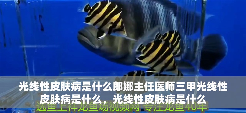 光線性皮膚病是什么郎娜主任醫師三甲光線性皮膚病是什么，光線性皮膚病是什么