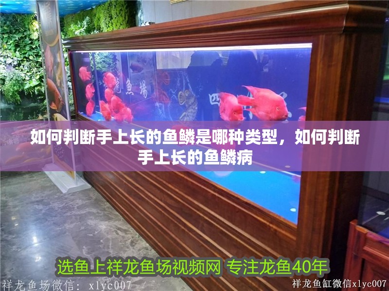 如何判斷手上長的魚鱗是哪種類型，如何判斷手上長的魚鱗病