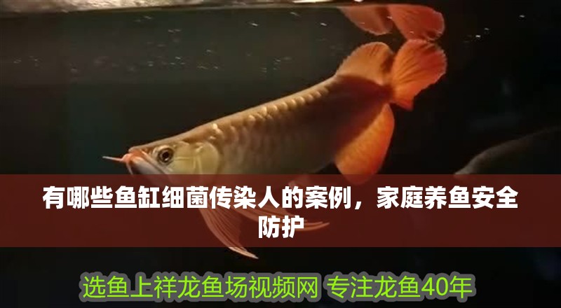 魚缸造景先放沙還是先放水(魚缸造景先鋪沙還是先放石頭) 有哪些魚缸細菌傳染人的案例,家庭養魚安全防護 龍魚百科 有哪些魚缸細菌傳染人的案例,家庭養魚安全防護 有哪些魚缸細菌傳染人的案例,家庭養魚安全防護 龍魚百科