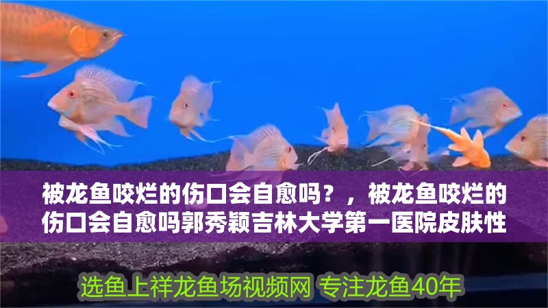 被龍魚咬爛的傷口會自愈嗎？，被龍魚咬爛的傷口會自愈嗎郭秀穎<strong><mark>吉林</mark></strong>大學(xué)第一醫(yī)院皮膚性病科