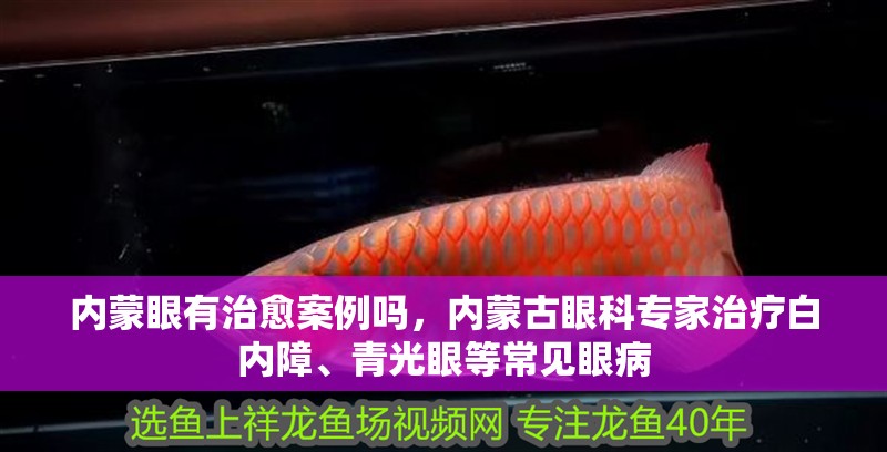 內蒙眼有治愈案例嗎，內蒙古眼科專家治療白內障、青光眼等常見眼病