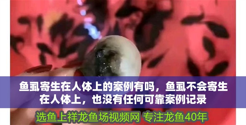 魚虱寄生在人體上的案例有嗎，魚虱不會寄生在人體上，也沒有任何可靠案例記錄