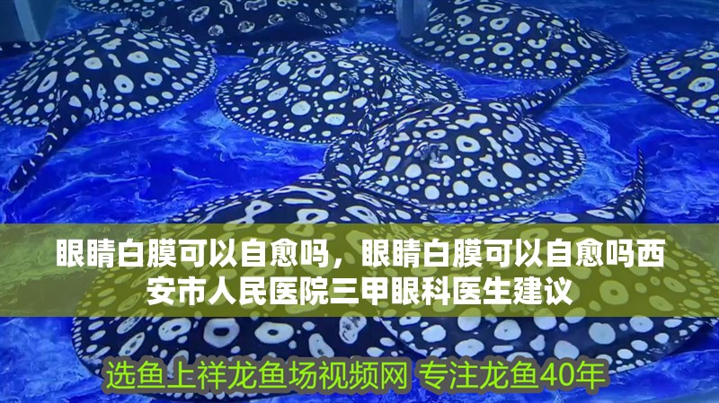 眼睛白膜可以自愈嗎，眼睛白膜可以自愈嗎西安市人民醫院三甲眼科醫生建議