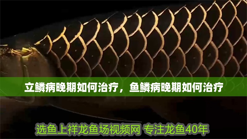 立鱗病晚期如何治療，魚鱗病晚期如何治療