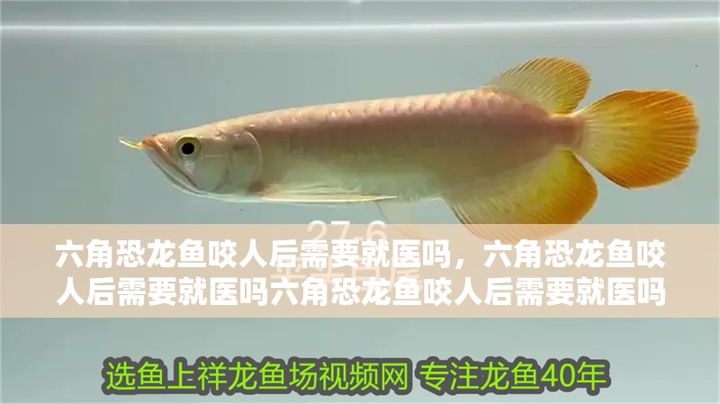 六角恐龍魚咬人后需要就醫(yī)嗎，六角恐龍魚咬人后需要就醫(yī)嗎六角恐龍魚咬人后需要就醫(yī)嗎