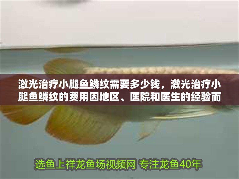 激光治療小腿魚鱗紋需要多少錢，激光治療小腿魚鱗紋的費用因地區、醫院和醫生的經驗而異