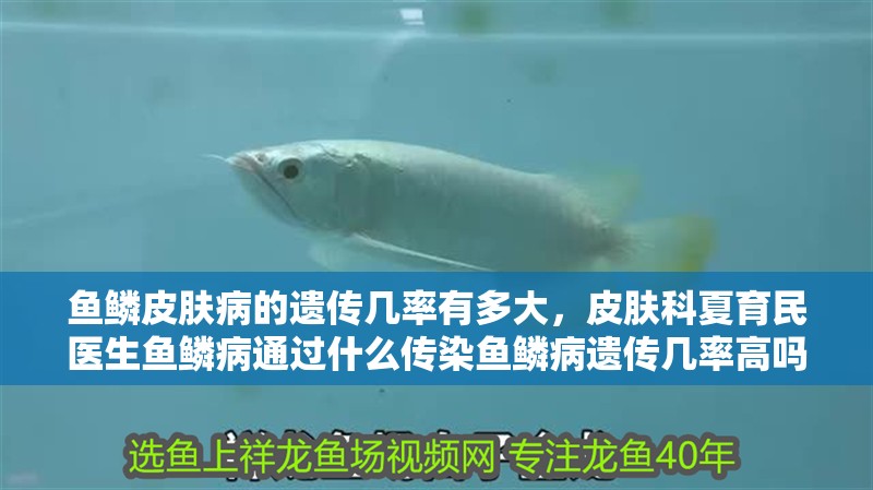 魚鱗皮膚病的遺傳幾率有多大，皮膚科夏育民醫(yī)生魚鱗病通過什么傳染魚鱗病遺傳幾率高嗎