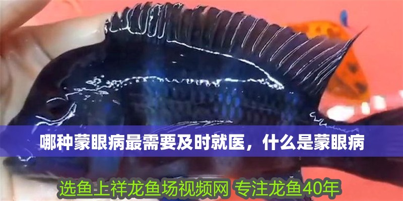 哪種蒙眼病最需要及時就醫，什么是蒙眼病