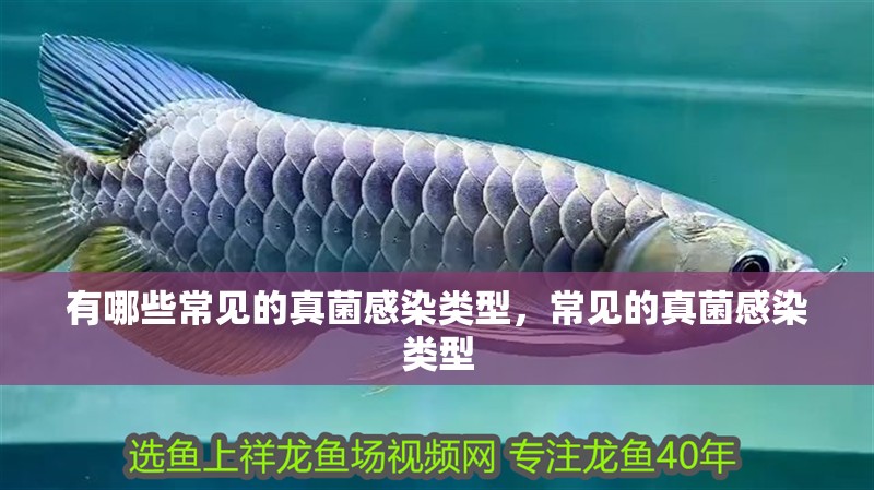 有哪些常見的真菌感染類型，常見的真菌感染類型