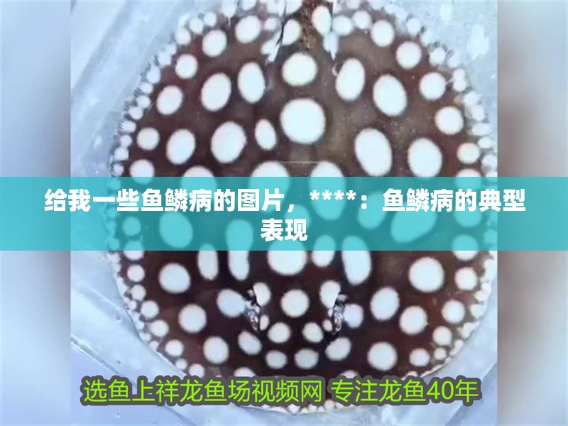 給我一些魚鱗病的圖片，****：魚鱗病的典型表現(xiàn)