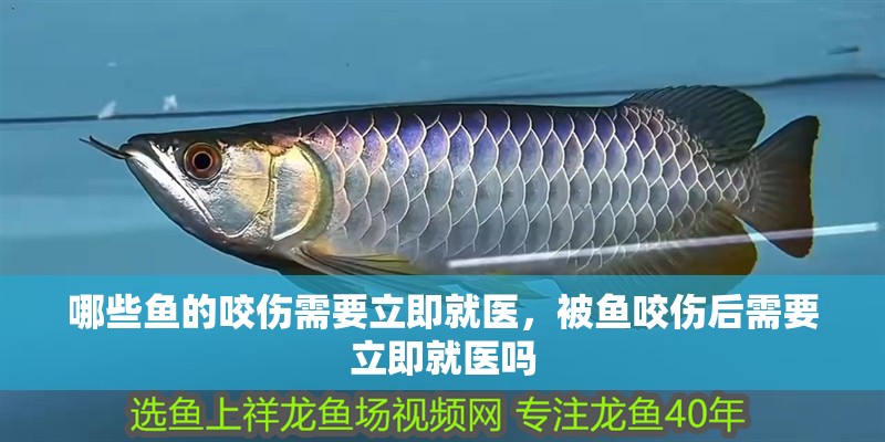 哪些魚的咬傷需要立即就醫，被魚咬傷后需要立即就醫嗎