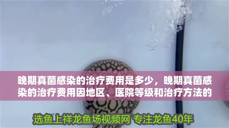 晚期真菌感染的治療費(fèi)用是多少，晚期真菌感染的治療費(fèi)用因地區(qū)、醫(yī)院等級(jí)和治療方法的不同而有所差異