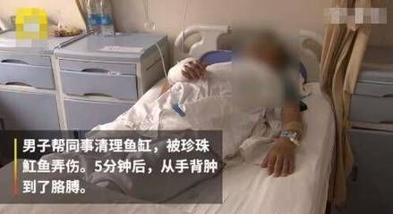 魟魚扎傷腫了怎么辦：被魟魚扎傷并且出現腫脹現象時是基于搜索結果的一些建議 魟魚扎傷腫了怎么辦：被魟魚扎傷并且出現腫脹現象時是基于搜索結果的一些建議 魟魚百科 第4張