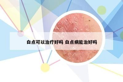 觀賞魚治療白點病需要停食嗎（治療觀賞魚白點病需要停止喂食嗎？）