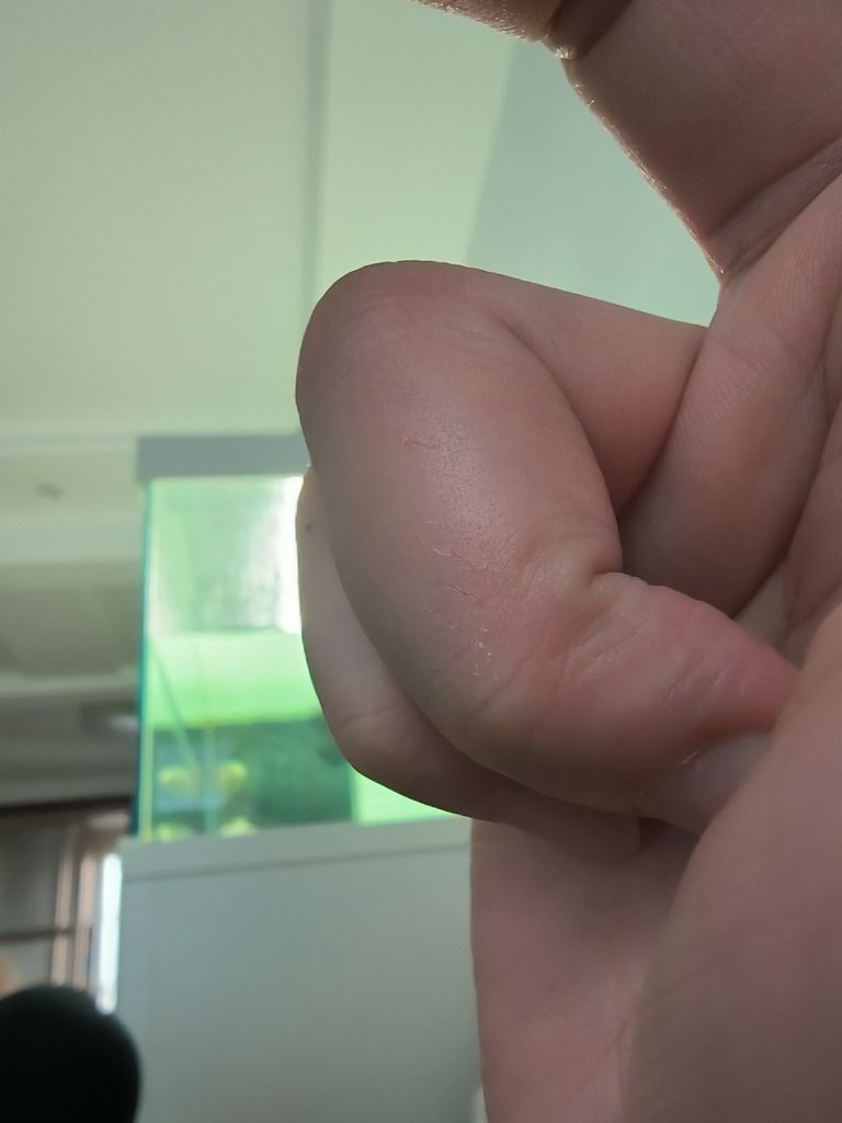 喂魚被咬