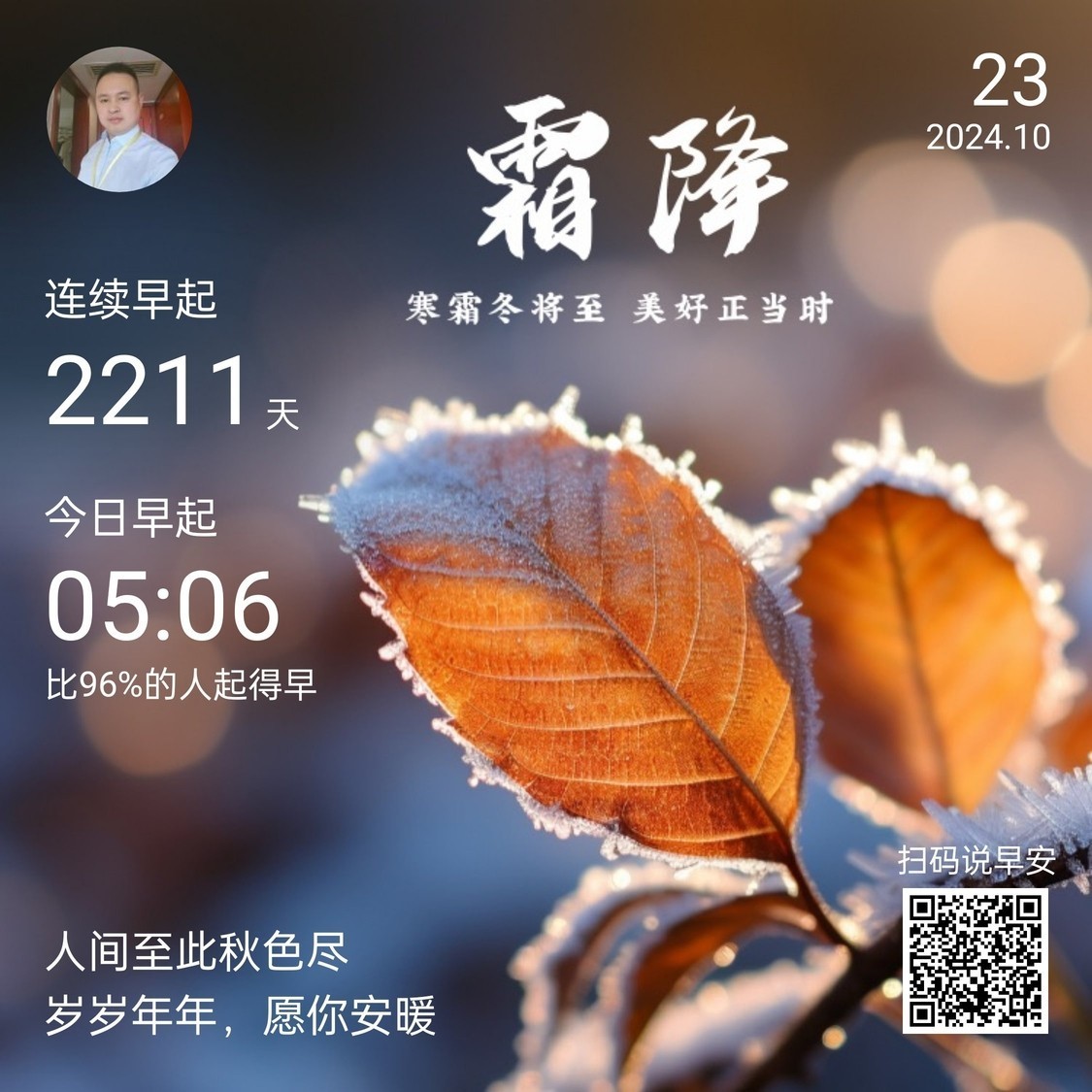 給大魚缸換水的作文:體驗給大魚缸換水的樂趣:體驗給大魚缸換水:給大魚缸換水的作文 今日霜降,秋盡冬來,寒意漸濃,這些 龍魚論壇 今日霜降,秋盡冬來,寒意漸濃,這些 今日霜降,秋盡冬來,寒意漸濃,這些 龍魚論壇