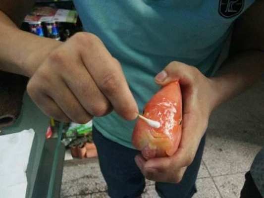 魟魚身上潰爛：魟魚身上出現潰爛可能是由于多種原因引起的，請注意