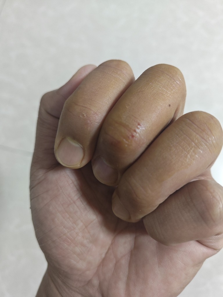活了37年，第一次被魚咬了，還是一條養了12年的老魚跳起來咬的。