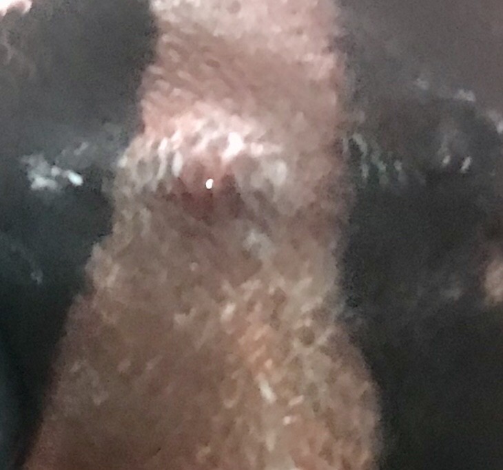 虎魚：身上有一個包是不是生病了