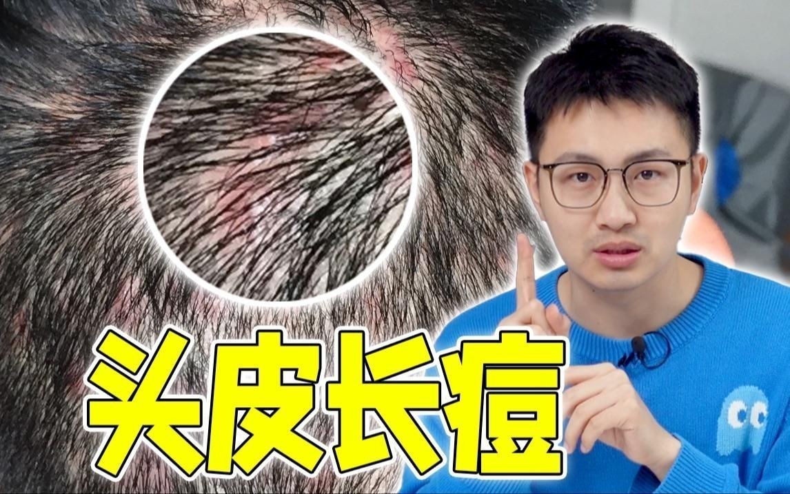 怎么判斷是真菌還是細菌，幾種不同風格的簡短標題示例供你參考，，辨真菌與細菌之法，區分真菌細菌妙招，識