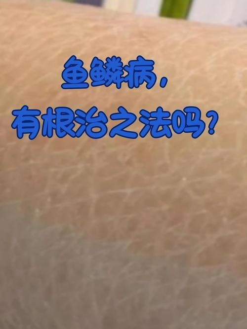豎鱗病圖片