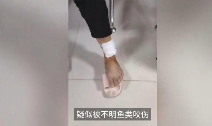 號(hào)半龍魚咬人后圖片