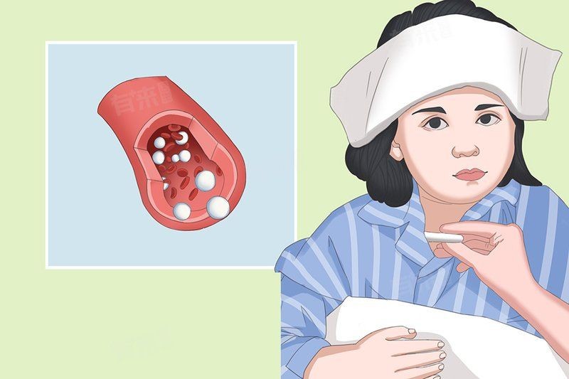 急性淋巴細(xì)胞白血病治愈率：兒童急性淋巴細(xì)胞白血病治愈率可達(dá)70%-80%-