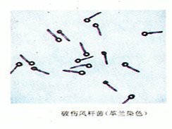 如何預防龍魚咬傷感染？|龍魚咬了出血了怎么辦黃耿文主任醫師三甲被咬出血了怎么辦