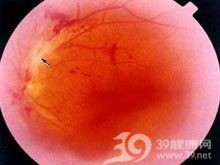魟魚懷孕最明顯癥狀【如何判斷魟魚是否懷孕】 龍魚論壇 第2張 魟魚懷孕最明顯癥狀【如何判斷魟魚是否懷孕】 魟魚懷孕最明顯癥狀【如何判斷魟魚是否懷孕】 龍魚論壇 第2張