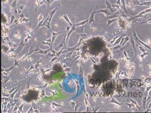 龍魚細菌感染多久能好【智能模式回答完成調用工具：百度健康龍魚細菌感染的治愈時間】