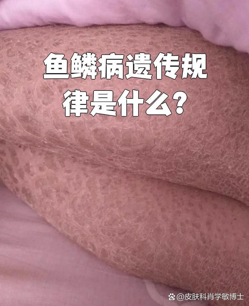 過背金龍珠鱗變異會遺傳嗎？【過背金龍珠鱗變異存在遺傳的可能性，但并非絕對】 過背金龍珠鱗變異會遺傳嗎？【過背金龍珠鱗變異存在遺傳的可能性，但并非絕對】 龍魚百科 第6張