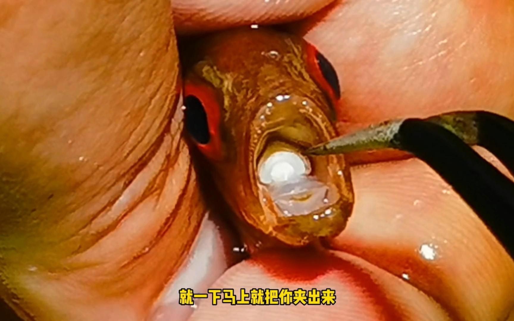 如何預防魚虱對人體的潛在影響？【`李燚副主任醫師三甲魚虱對人體有危害嗎】 如何預防魚虱對人體的潛在影響？【`李燚副主任醫師三甲魚虱對人體有危害嗎】 龍魚百科 第1張