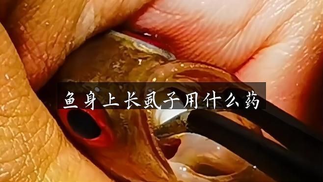 哪種方法治療魚虱最有效？【治療魚虱感染的最有效方法】