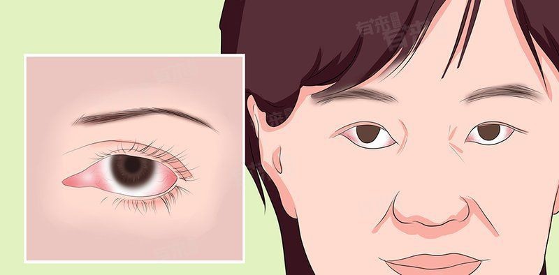 蒙眼病會傳染其他魚嗎？【紅眼病傳播途徑是什么】