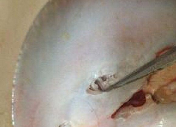 魟魚狀態(tài)不好的表現(xiàn)【魟魚健康狀態(tài)異常的十二種表現(xiàn)及應(yīng)對(duì)策略】 魟魚狀態(tài)不好的表現(xiàn)【魟魚健康狀態(tài)異常的十二種表現(xiàn)及應(yīng)對(duì)策略】 龍魚論壇 第3張