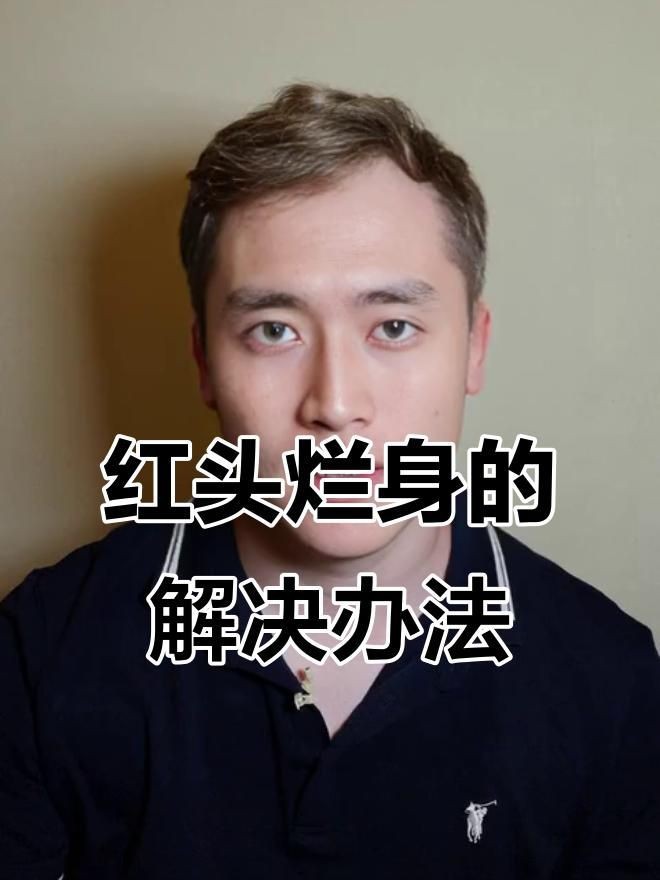 如何預防魚爛身病的再次發生？【冬季魚塘紅頭爛身原因及防治方法全民小視頻全民小視頻】